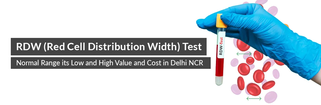  RDW (Red Cell Distribution Width) Test: Normal Range And Cost in Delhi